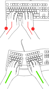 Ergonomische Tastatur RSI Syndrom